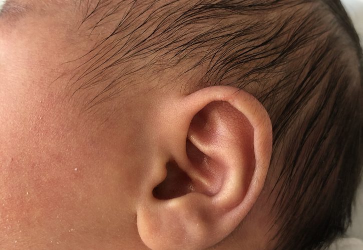 新生児聴覚検査の助成が始まります